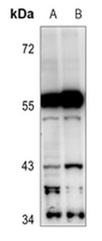 Anti-Cytochrome P450 2C19 Antibody