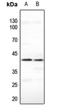 Anti-CDKL1 Antibody