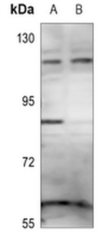 Anti-ZNF148 Antibody