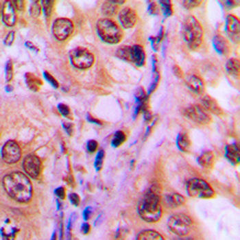 Anti-SGK1/2 (pT256/253) Antibody