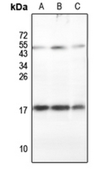 Anti-RPLP2 Antibody