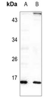 Anti-RPL22 Antibody