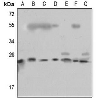 Anti-RPL18 Antibody