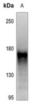 Anti-RET (pY1062) Antibody
