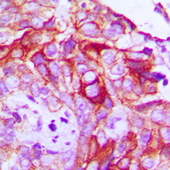 Anti-RET (pY1062) Antibody