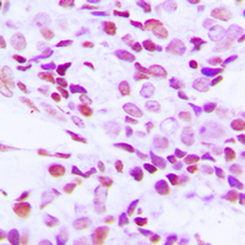 Anti-hnRNP G Antibody