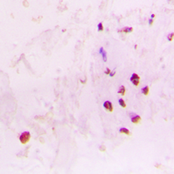 Anti-RAD17 Antibody