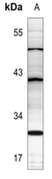 Anti-PTTG1IP Antibody