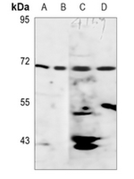 Anti-AMPK gamma 2 Antibody