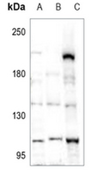 Anti-POM121 Antibody