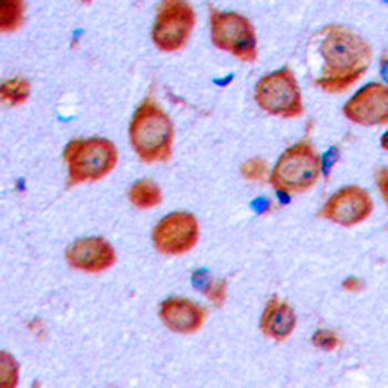 Anti-OLFML2A Antibody