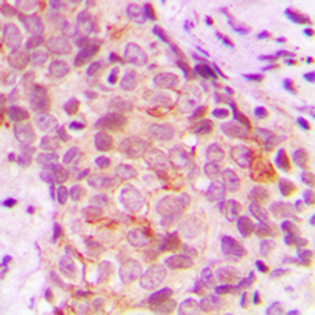 Anti-MARK3 Antibody