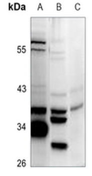 Anti-HLA-H Antibody