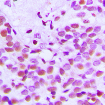 Anti-Histone H3 (AcK18) Antibody