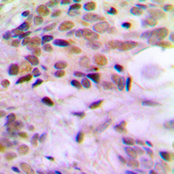 Anti-ERCC5 Antibody