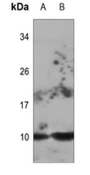 Anti-DYNLL2 Antibody