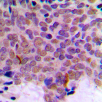 Anti-CLK1 Antibody