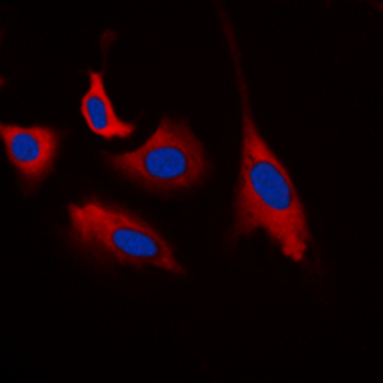 Anti-CDK5 (pY15) Antibody