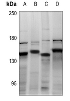 Anti-CDCA2 Antibody