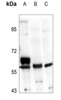 Anti-ALDH1A2 Antibody