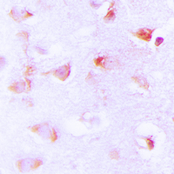 Anti-ACC alpha (pS80) Antibody
