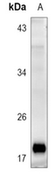 Anti-REG4 Antibody