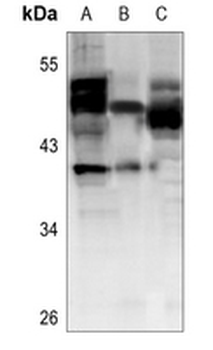 Cathepsin F Antibody