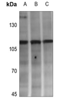 Adenylate Cyclase 4 Antibody