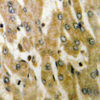 Anti-ACOT4 Antibody