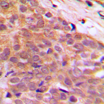 Anti-CABLES1 Antibody