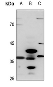Anti-AKR1CL2 Antibody