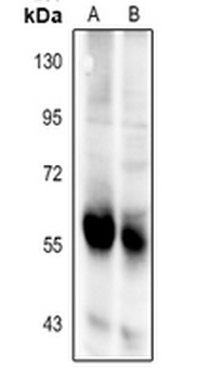 Anti-BAIAP2L2 Antibody