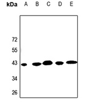 Anti-KCNK15 Antibody