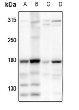 Anti-HECW2 Antibody