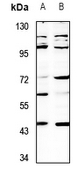 Anti-SH3GLB2 Antibody