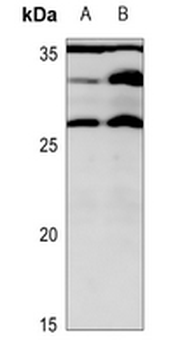 Anti-MRPL16 Antibody