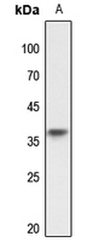 Anti-TRA2A Antibody