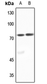 Anti-ACSL6 Antibody