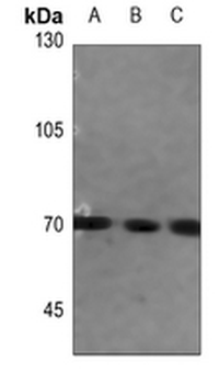 Anti-FATP5 Antibody