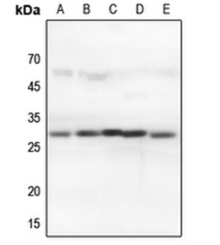 Anti-14-3-3 theta/tau Antibody