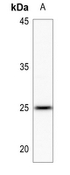 Anti-LYPLA1 Antibody