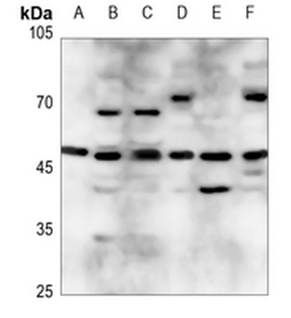 Anti-ZNF174 Antibody