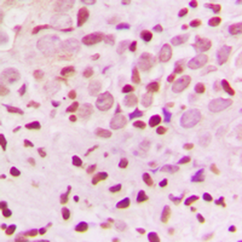 Anti-ZNF174 Antibody