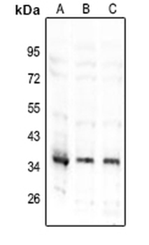 Anti-TNFAIP1 Antibody