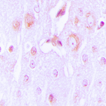 Anti-Tyrosine Hydroxylase Antibody