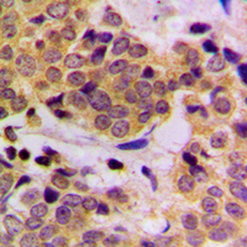Anti-SHPTP2 (pY542) Antibody