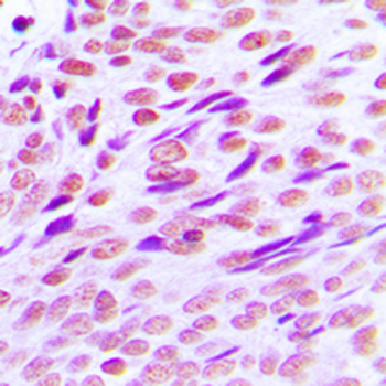 Anti-CTBP2 Antibody