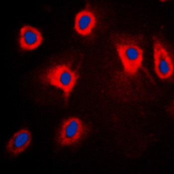 Anti-TPL2 (pT290) Antibody