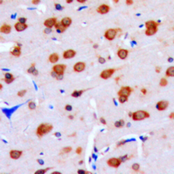 Anti-DUSP16 Antibody