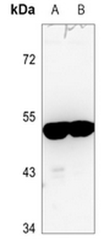 Anti-ARRDC3 Antibody